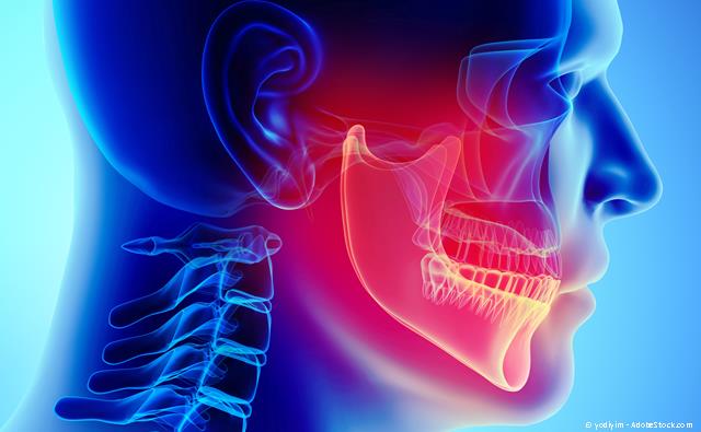 CMD-Behandlung bei Zähneknirschen